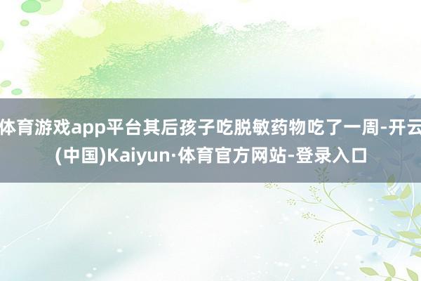 体育游戏app平台其后孩子吃脱敏药物吃了一周-开云(中国)Kaiyun·体育官方网站-登录入口